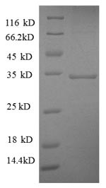 Succinate dehydrogenase [ubiquinone] flavoprotein subunit, mitochondrial (SDHA),partial, human, reco