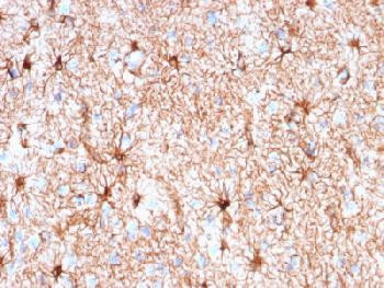 Anti-GFAP (Astrocyte &amp; Neural Stem Cell Marker) Recombinant Mouse Monoclonal Antibody (clone:rASTRO/