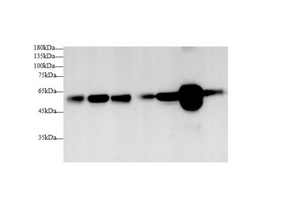 Anti-beta Tubulin, clone 2E8-2