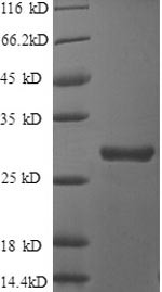 Clusterin (CLU), partial, human, recombinant