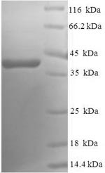 Ras-related protein Rab-5A (RAB5A), human, recombinant