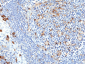 Anti-PD-L1 (human), Rabbit Monoclonal (RM320)