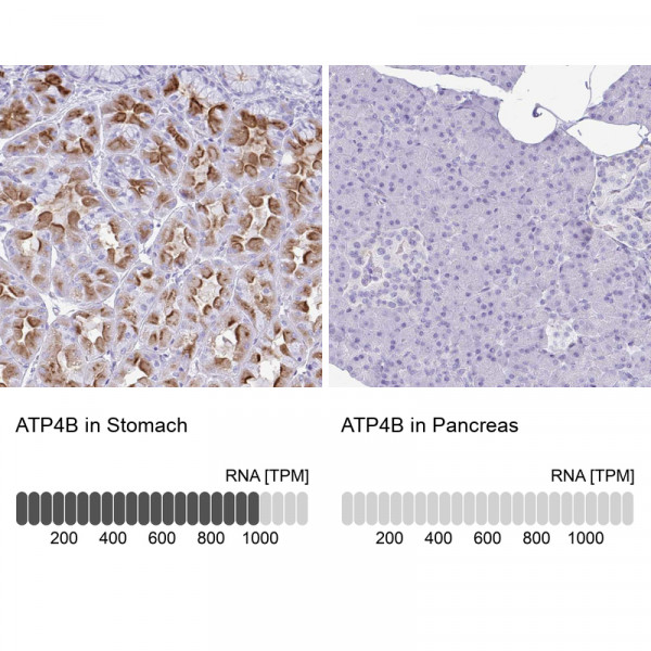 Anti-ATP4B