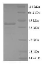 Gamma-aminobutyric acid receptor-associated protein-like 2 (GABARAPL2), human, recombinant