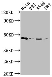 Anti-MAP2K1 Recombinant Monoclonal, clone 3F10