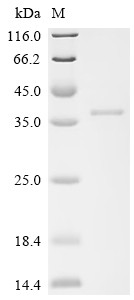 Deoxyribonuclease-1-like 2 (DNASE1L2), human, recombinant