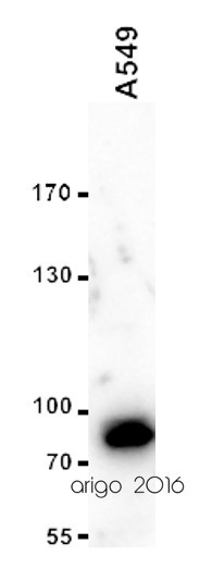 Anti-TRPC6