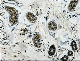 Anti-TUBB3 Monoclonal