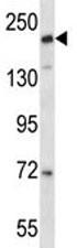 Anti-CD163L1