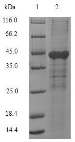 Carcinoembryonic antigen-related cell adhesion molecule 1 (CEACAM1), partial, human, recombinant