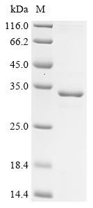 Mucin-4 (Muc4), partial, mouse, recombinant