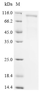 Succinate dehydrogenase [ubiquinone] flavoprotein subunit, mitochondrial (SDHA), partial, human, rec