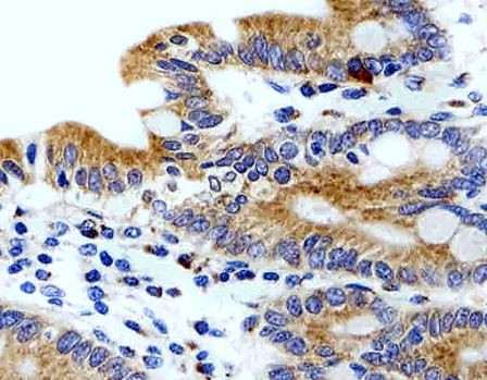 Anti-alpha 1D Adrenergic Receptor