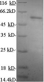 Estrogen receptor beta (ESR2), partial, human, recombinant