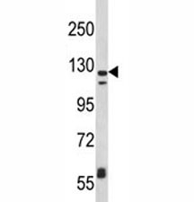 Anti-CD11c