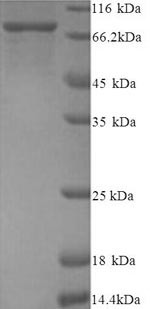 Protein-arginine deiminase type-2 (PADI2), human, recombinant