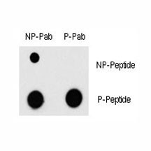 Anti-phospho-MEF2C (Thr300)