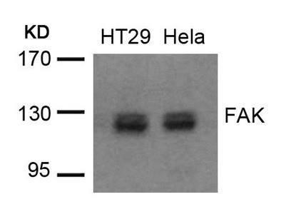 Anti-PTK2 (Ab-576/577)