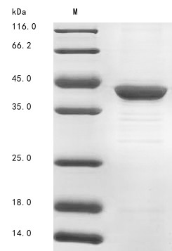 Fructose-1,6-bisphosphatase 1 (FBP1), human, recombinant