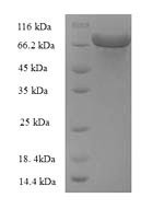 Glucose-6-phosphate 1-dehydrogenase (zwf), partial, Escherichia coli, recombinant