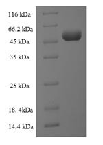 Very long-chain acyl-CoA synthetase (SLC27A2), partial, human, recombinant