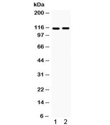 Anti-Eph Receptor A5 / EphA5