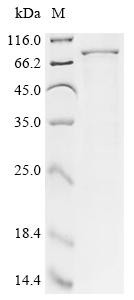 Small conductance calcium-activated potassium channel protein 2 (Kcnn2), partial, mouse, recombinant
