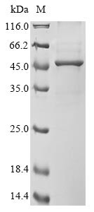 Acetyl-CoA acetyltransferase, cytosolic (ACAT2), human, recombinant