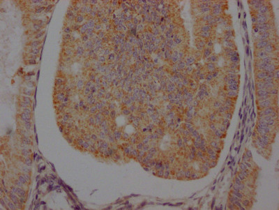 Anti-ADRB2 Recombinant Monoclonal, clone 4C11