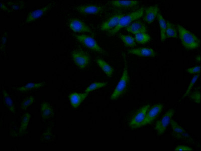 Anti-NFE2L2 Recombinant Monoclonal, clone 2D12