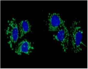 Anti-ACAT1, clone 15E5