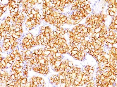 Anti-Renal Cell Carcinoma (Carbonic Anhydrase IX)(PN-15), Biotin conjugate, 0.1mg/mL
