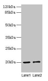 Anti-COX4I1