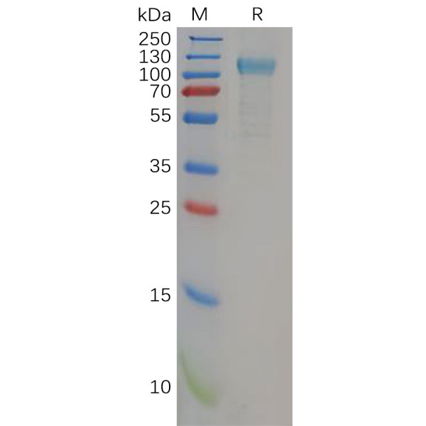 Human TLR3 Protein, His Tag