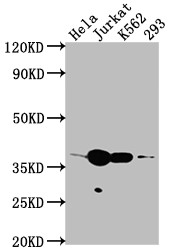 Anti-CDK6 Recombinant Monoclonal, clone 8G3