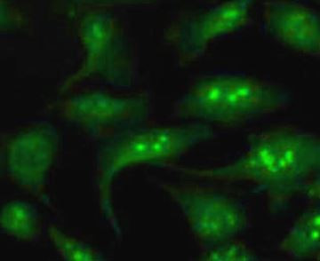 Anti-Phospholipase C beta 1