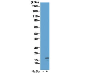 Anti-H3K18ac / Acetyl Histone H3 Lysine 18, clone RM166 (recombinant antibody)