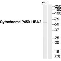 Anti-CYP11B1/CYP11B2