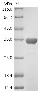 14-3-3 protein sigma (SFN), human, recombinant