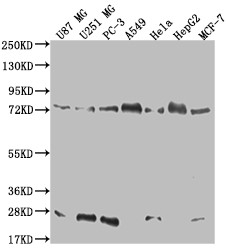 Anti-CAPN2 Recombinant Monoclonal, clone 17E9