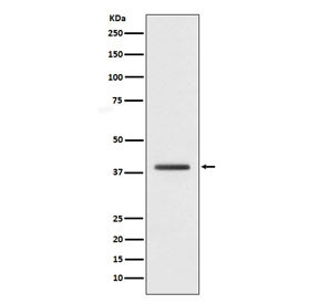 Anti-H2AFY / Macro H2A.1, clone ADDI-8