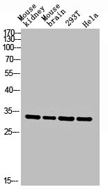 Anti-CA2