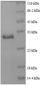 Actin, cytoplasmic 1 (ACTB),partial, human, recombinant