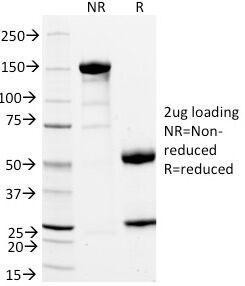 Anti-CD11a, clone DF1524