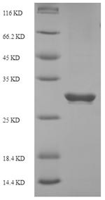 Programmed cell death protein 1 (PDCD1), partial, human, recombinant
