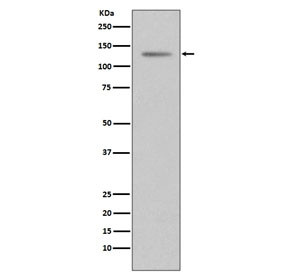 Anti-Progesterone Receptor, clone EFC-16
