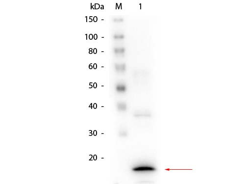 Anti-Procalcitonin, clone 4C8.H6.D4