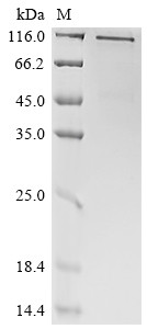 CD70 antigen (CD70), partial, human, recombinant