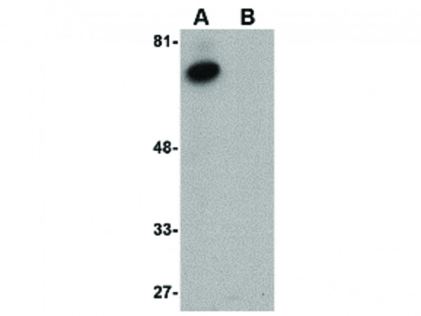 Anti-ACVR1B