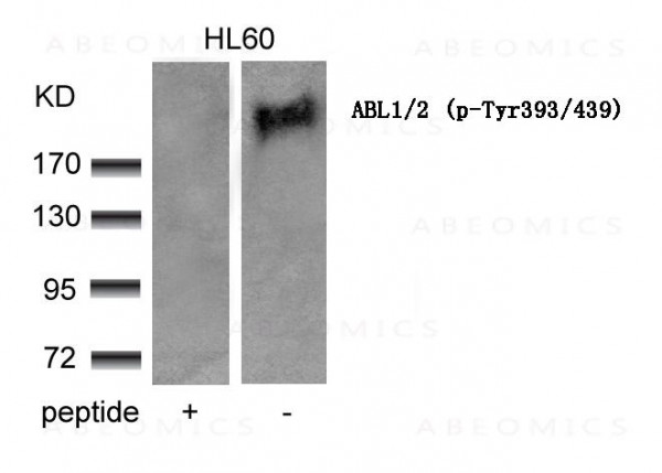 Anti-ABL1/2 (phospho-Tyr393/439)